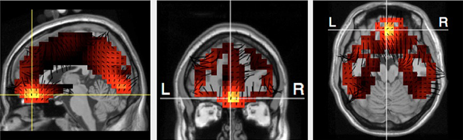 Brain scans